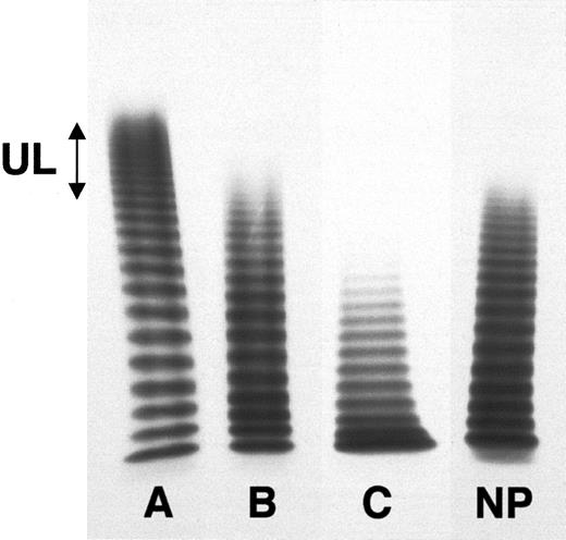 Fig. 3. Various multimeric patterns of plasma vWF observed in patients with acute TMA. / The multimeric distribution of vWF was studied using 0.1% sodium dodecyl sulfate, 1% agarose gel electrophoresis under nonreducing conditions. About 1 mIU vWFAg was loaded in each well. After migration and washing, the gels were incubated with a 125I-goat polyclonal antibody to vWF. After extensive washing, vWF-associated radioactivity was revealed by autoradiography. Patients with acute TMA show, respectively, an increased proportion of HMW multimers, including UL forms (A), a normal multimeric distribution (B), and a partial loss of the HMW (C). NP indicates normal pooled plasma.