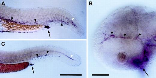 Fig. 4. Expression of klf2a in the pharyngula-stage zebrafish embryo. / Whole-mount in situ hybridization of zebrafish embryos with riboprobe for the zebrafish klf2a gene. Embryos are shown in lateral view with anterior to the left and dorsal up. Scale bars are 100 μm (A,C) and 50 μm (B). (A) Trunk and tail of a 24-hour post-fertilization (hpf) embryo showing klf2a expression in cells closely associated with the axial vessels (black arrowheads), the anus (arrow), and superficial cell clusters (white arrowhead). (B) Head of a 24-hpf embryo showing klf2a expression in head vessels (arrowheads) and heart (arrow, out of plane of focus). (C) Trunk and tail of a 36-hpf embryo showing klf2a expression denoted as in panel A. Original magnification in panels A and C 100 ×, panel B 200 ×; stained with NBT/BCIP precipitate.