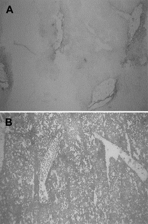 Fig. 2. Presence of heme in the liver. / Heme was assayed by benzidine staining of liver sections of BALB/c mice treated for 4 hours with saline or 1000 μM heme. In control mice (A), heme was confined to the vicinity of vessels, whereas in heme-treated mice (B) most liver cells stained positive (dark staining).