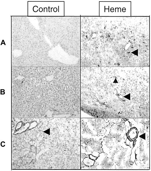 Fig. 7. Effect of heme on leukocyte infiltration and adhesion molecule expression. / Immunohistochemical analysis of liver and pancreas tissues of BALB/c mice after 24 hours of intravenous injection with either saline (left panel) or heme (750 μM) (right panel). (A) Detection of granulocytes (dark staining, arrowhead) in the liver using immunohistochemical analysis. Note the pronounced influx of granulocytes into the liver of heme-treated mice (GR-1 antibody). (B) ICAM-1 immunoreactive proteins (dark staining) in liver sections of mice treated with saline or heme (YN1/1 antibody). ICAM-1 can be identified on the endothelial lining (arrowhead) and on infiltrating leukocytes of heme-treated animals (small arrowhead). (C) Localization of fibronectin in pancreas sections (dark staining, arrowhead) (A0245 antibody). The expression of fibronectin proteins was clearly enhanced in the heme-treated animals (dark staining, arrowhead).