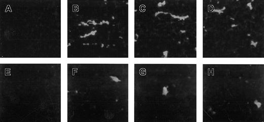 Fig. 2. Thrombi formed after treatment with VT-1. / Micrographs show thrombi formed on HMEC-1 (A-D) and HUVEC (E-H) treated with VT-1. Cells were incubated with control medium (A,E) or with VT-1 at 2 pM (B,F), 10 pM (C,G), 50 pM (D,H) for 24 hours, perfused with blood at 60 dynes/cm2, and examined by confocal microscopy. Digitized representative fields are shown.