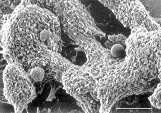 Fig. 3. Scanning electron micrograph of thrombi on HMEC-1. / HMEC-1 treated with VT-1 (10 pM) reveal organized thrombi with entrapped leukocytes at different stages of activation.