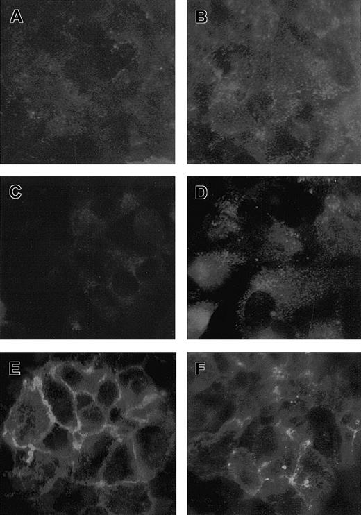 Fig. 8. Expression of adhesive molecules in HMEC-1 treated with VT-1. / Micrographs of HMEC-1 treated with control medium (A,C,E) or VT-1 (10 pM, 24 hours; B,D,F) and stained for vitronectin receptor αvβ3 (A,B), P-selectin (C,D), and PECAM-1 (E,F). HMEC-1 exposed to VT-1 showed an increased surface expression of vitronectin receptor and P-selectin as a diffuse granular pattern. PECAM-1 appeared redistributed away from the cell junctions after VT-1 treatment (n = 3 experiments).