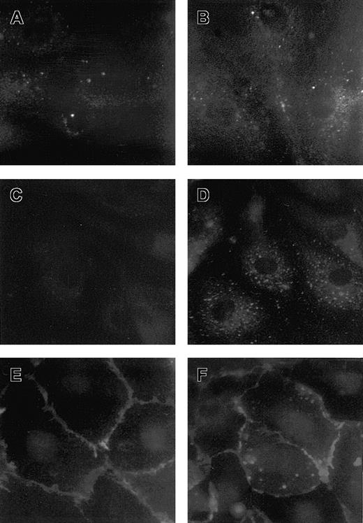 Fig. 9. Expression of adhesive molecules in HDMECs treated with VT-1. / Micrographs of HDMEC treated with control medium (A,C,E) or VT-1 (10 pM, 24 hours; B,D,F) and stained for vitronectin receptor αvβ3 (A,B), P-selectin (C,D), and PECAM-1 (E,F). HDMEC exposed to VT-1 showed an increased surface expression of vitronectin receptor and P-selectin as a diffuse granular pattern. PECAM-1 appeared redistributed away from the cell-cell border and irregular patches of staining were evident along the periphery of the cells after VT-1 treatment (n = 3 experiments).