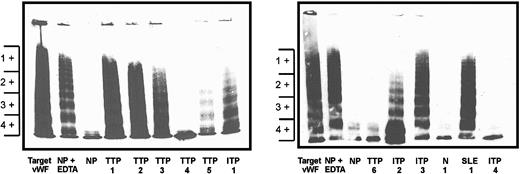Fig. 1. VWF multimer analysis of the metalloprotease proteolysis of target vWF induced by samples from patients with various thrombocytopenic disorders and control samples. / These 2 multimer gels represent the analysis of the vWF protease activity in some of the samples tested. After promoting digestion, the amount of vWF protease activity was determined by comparing the height of each individual multimer column to the target vWF (on the left of each gel), which represents 0 proteolysis. Following the metalloprotease activation assay, a decrease in the large-molecular-weight forms of the target vWF indicated normal vWF protease activity, and these samples were given scores of 3+ or 4+. The normal pooled serum (NP) demonstrated normal proteolysis. The addition of EDTA to the normal pool (NP + EDTA) prior to enzyme activation inhibited the protease activity and showed reduced protease activity with scores of 1+ or 2+. Target vWF, vWF plus normal pool, and vWF plus normal pool with added EDTA were run on each gel as standards. Some TTP samples (TTP 1, 2, 3, 5) had reduced vWF protease activity (1+ to 2+). Other samples from TTP patients (TTP 4 and 6) had normal vWF protease activity (3+ to 4+) and were indistinguishable from control or normal samples. Samples from patients with other thrombocytopenic disorders (ITP 1, 2, 3 and SLE 1) also had reduced vWF protease activity.