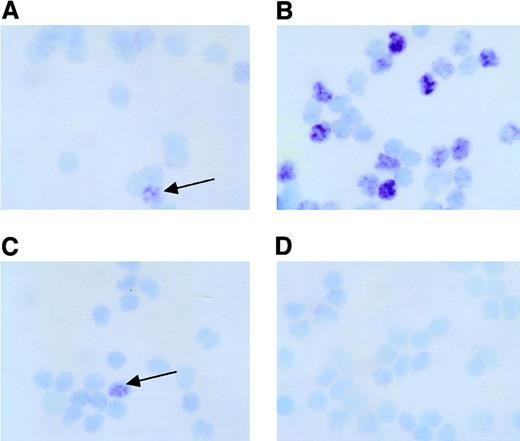Fig. 2. Detection of EBER-1+ cells in lymphocyte subpopulations in patients with EBV-HLH. / PBMNCs obtained from patient EBV-HLH2 at 8 days after onset were separated into CD4+ T cells (A), CD8+ T cells (B), CD16+ NK cells (C), or CD20+ B cells (D) by electronic sorting using EPICS-Elite as described. The presence of EBER-1 mRNA was detected by ISH in each cytocentrifuged cell subpopulation. The arrows indicate EBER-1+cells. Original magnification × 400.