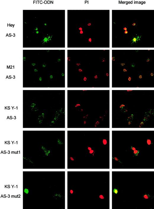 Fig. 3. Fluorescein-tagged VEGF ODNs are taken up by various tumor cell lines in vitro. / Shown are the FITC images in the first column of treatments as indicated and the propidium iodide (PI) nuclear stain in the second column. Overlay images of ODN fluorescein signal exposed to AS-3, AS-3 mut1, and AS-3 mut2 (1 μM) are in the third column and show colocalization of the FITC and PI staining, indicating that the ODNs have entered the nuclei. Control was no treatment (no fluorescent AS-ODN; not shown).