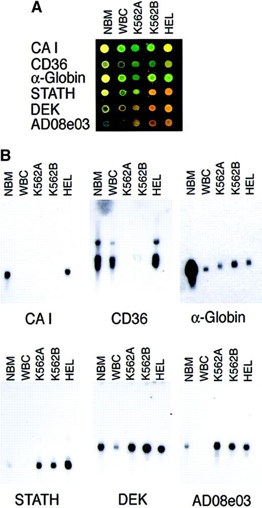Fig. 3. Cell line comparisons and Northern blot confirmation analyses. / (A) Array-based transcription patterns for bone marrow (Cy3) versus Cy5-labeled bone marrow (NBM), peripheral blood mononuclear cells (WBC), K562 erythroleukemia cells from 2 sources (K562A, K562B), and the HEL erythroleukemia cell line. K562B RNA was the source used for all subsequent E-chip hybridizations in this study. (B) Northern blots probed for representative proliferation- and differentiation-associated genes. Each lane contained 2.5 μg mRNA from carbonic anhydrase I (CAI), CD36, Stathmin (STATH), DEKoncogene (DEK), and hembase clone Ad08c04 (Ad08c04).