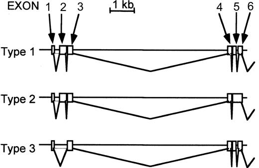 Fig. 2. Alternative forms of murine TfR2 transcripts. / Using primers for 5′ and 3′ ends of the murine TfR2 coding region, the transcripts were amplified by RT-PCR, cloned, sequenced, and compared with the genomic sequences. The sequences of the primers are 5′-CACAAGCATGGAGCAACGTTGG-3′ and 5′-AGGGAGAAAGGAGAATCACGTGG-3′. Type 1 is the representative form, which is identical to that cloned by 5′ and 3′ RACE. Type 2 is a longer form that has additional sequences (intron 5 in the type 1) between exons 5 and 6. Type 3 is a shorter form that lacks exon 2. Sequences after exon 6 were the same in all 3 types, so only the 5′ portion of this gene (exons 1-6) is shown in this figure.