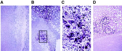 Fig. 3. In situ hybridization for MV nucleocapsid (N) mRNA in ARH-77 tumor xenografts treated with MV-Edm. / (A) Tumor injected with UV-inactivated measles virus stained negative for MV-N mRNA. (B) Tumor injected directly with a single dose of 107 pfu active MV-Edm and harvested 3 days later showed positive (dark purple) staining in tumor cells/syncytia, indicating viral replication. (C) Higher magnification of boxed area. (D) Tumor harvested 7 days after mouse was injected intravenously through the tail vein with 1 dose of 107 pfu active MV-Edm also showed positive staining for MV-N mRNA in the tumor tissue.