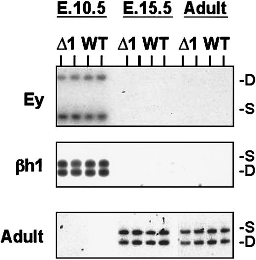 Fig. 2. Expression of β-like globin genes in Δ1/wild-type heterozygous mice. / The HbbD allele (D) carries the targeted mutation, while the HbbS allele (S) is wild type. RNA was analyzed from dpc 10.5 yolk sac, dpc 15.5 fetal liver, and adult peripheral blood by means of RT-PCR assays for Ey, βh1, and adult primers (top, middle, and bottom panels). WT indicates wild-type D/S animals; Δ1 indicates mutant Δ1/S heterozygous mice. S and D mark the RT-PCR products from the S and D alleles, respectively.