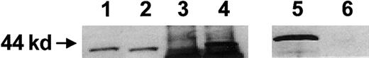 Fig. 5. Subcellular localization of Mpl fusion proteins. / COS-1 cells were transiently transfected with constructs encoding either the membrane-targeted Mpl or the cytoplasmic Mpl fusion protein. Whole cell lysates, membrane fractions, and cytoplasmic fractions were obtained and analyzed by Western blotting with an antibody directed against the HA epitope tag. Lanes 1, 3, 5: membrane-targeted Mpl construct; lanes 2, 4, 6: cytoplasmic Mpl construct; lanes 1, 2: whole cell lysate; lanes 3, 4: cytoplasmic fraction; lanes 5, 6: membrane fraction.