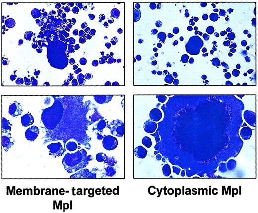Fig. 6. Photomicrographs of murine marrow cells expressing Mpl fusion proteins. / Cells transduced with either the membrane-tethered Mpl construct (left panel) or the cytoplasmic Mpl construct (right panel) were cultured in the presence of AP20187 (100 nM) for 102 days, then photographed. Magnification: top panels, × 40; bottom panels, × 100.