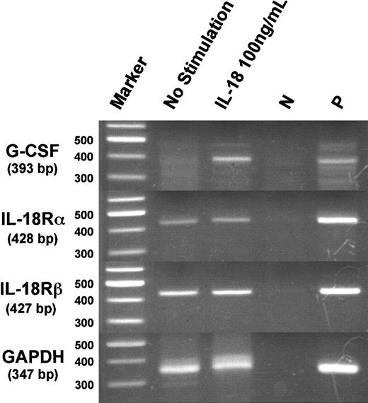Fig. 5. Expression of messenger RNAs of murine G-CSF and IL-18Rα and IL-18Rβ in splenic adherent cells following stimulation with IL-18. / Splenic adherent cells (2 × 107 cells) were treated with IL-18 (100 ng/mL) for 6 hours, and messenger RNAs of G-CSF, IL-18Rα, IL-18Rβ, and GAPDH were analyzed by RT-PCR. Messenger RNA of lipopolysaccharide (LPS)-stimulated peritoneal macrophages was used as a positive (P) control. For negative control (N), the above mRNA was subjected to PCR reaction without prior RT reaction.