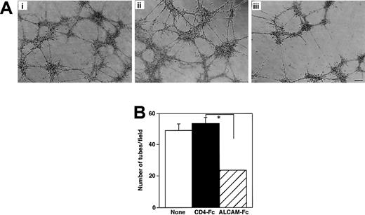 Fig. 6. Endothelial tube formation in Matrigel. / (A) Yolk sac–derived endothelial cells were plated in Matrigel and cultured for 60 hours without factor (Ai) or with CD4-Fc (Aii) or ALCAM-Fc (Aiii). Scale bar, 50 μm. (B) The number of tubes formed in Matrigel was counted in each field under a microscope, and mean ± SD was obtained from quadriplicate wells. *P < .05.