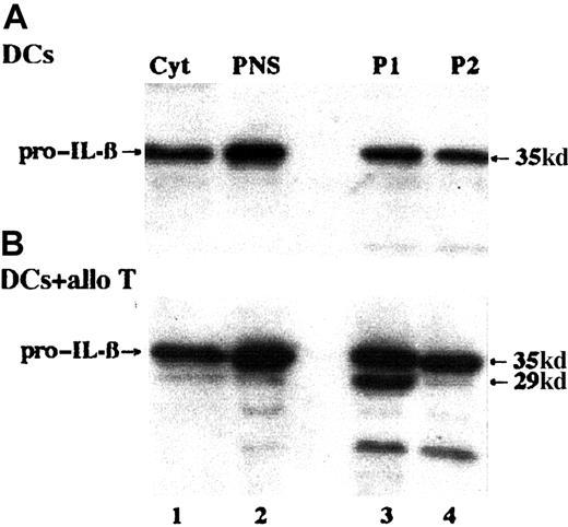 Fig. 2. Pro–IL-1β is present in P1 and P2 fractions; processing on interaction with alloreactive T cells. / P1 and P2 fractions (lanes 3 and 4) were obtained by sequential ultracentrifugation of PNS from mature DCs cultured 5 hours alone (A) or with alloreactive CD8+ T cells (at a DC/T cell ratio of 1:10, panel B), treated with proteinase K and solubilized in sample buffer. Lane 1: cytosol (TCA-concentrated, 1/20 of total, 100 μg); lane 2: PNS (1/20 of total). Samples were blotted and hybridized with anti–IL-1β mAb. Note the appearance of the ICE-specific 29-kd IL-1β band, of approximately the same intensity as the 35-kd, in P1 from DCs cultured with alloreactive T cells (B, lane 3). The low-molecular-weight band (17 kd) in lanes 3B and 4B is erratic and probably due to nonspecific endoproteases activated during the preparation of the samples, as already reported.10 One representative experiment of 5 is shown.