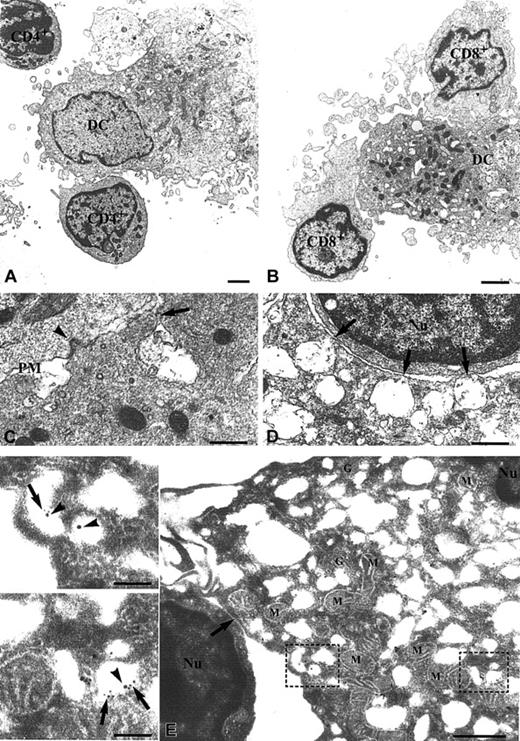 Fig. 7. Polarization of DC endolysosomes toward the interacting CD8+ T cells. / Ultrastructural analysis of the interaction of DCs with CD4+ (A) or CD8+ (B-D) allospecific T cells. Cells were cocultured for 5 hours and processed for conventional thin section electron microscopy. Interaction between DCs and CD4+ T cells occurs primarily in correspondence with the DC areas occupied by the nucleus and is not characterized by polarization of cellular organelles (A). In DCs interacting with CD8+ T lymphocytes, both mitochondria and endolysosomal structures are polarized toward the areas of contact at the opposite site of the cell portion containing the nucleus (B). Panels C and D show details of a tight contact between the plasma membranes of the interacting cells (arrowhead in panel C) and of fusion sites of endolysosomes with the DC plasma membrane (arrows in panels C and D). (E) Immunoelectron microscopic analysis of the localization of IL-1β and cathepsin D in DCs interacting with CD8+ T cells. Double immunogold labeling with anticathepsin D (large gold particles) and anti–IL-1β (small gold particles) antibodies shows the colocalization of the 2 proteins in endolysosomal structures in the DC cytoplasm oriented toward the cell contact with a CD8+ T lymphocyte (arrow). Insets with enlargement of the areas in dotted boxes show groups of endolysosomes double-labeled for IL-1β (arrows) and cathepsin D (arrowheads). PM indicates plasma membrane; Nu, nucleus; M, mitochondria; and G, Golgi complex. Bars in panels A and B are 2 μm; in panels C and D, 0.5 μm; in insets, 0.1 μm.