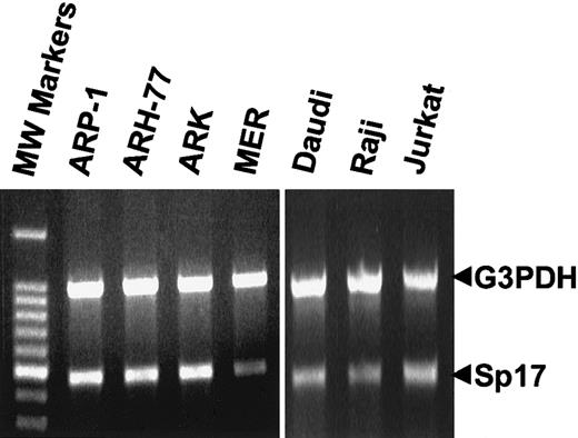 Fig. 1. Sp17 mRNA in human lymphoid cell lines. / The 456-bp open reading frame of Sp17 was amplified by RT-PCR from the total RNA of lymphoid tumor cell lines (ARH-77, plasma cell leukemia; ARP-1, ARK, and MER, myeloma; Daudi and Raji, Burkitt lymphoma; Jurkat, T-cell lymphoma). As an internal standard, the 983-bp fragment of G3PDH was amplified along with the Sp17 in the same PCR reaction. A negative control (no template) was performed during each RT-PCR reaction (not shown).