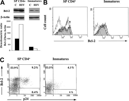Fig. 7. Expression of Bcl-2 and intracellular p24 in SP CD4+ and immature thymocytes. / Cells were isolated as described in “Materials and methods,” infected with a primary isolate HIV-1B-LAIp, and maintained in culture in the presence of IL-7 (5 ng/mL), TNF-α (1 ng/mL), IL-1 (10 ng/mL), and IL-6 (10 ng/mL) for 11 days. (A) Bcl-2 expression was analyzed by Western blot on cell extracts from both control (C) and infected cells (HIV) in comparison with β-actin as a protein of unchanged expression. Quantification was determined as a ratio of Bcl-2/β-actin after densitometry analysis of the autoradiogram. Data are presented as the mean of independent experiments carried out with thymuses from 5 different donors. (B) Bcl-2 expression was analyzed by immunostaining and flow cytometry in uninfected (white area) and infected thymocytes (gray area). Dotted line indicates isotypic control. The arrow indicates the shift of the peak of Bcl-2–positive cells on infection. The experiment presented here is representative of independent experiments carried out with thymuses from 2 different donors. (C) Bcl-2 and intracellular p24 expression was analyzed by double immunostaining and flow cytometry in HIV-infected thymocytes. Percentages of single- and double-labeled cells are indicated in each quadrant. The experiment presented here is representative of independent experiments carried out with thymuses from 2 different donors.