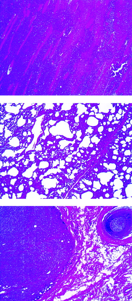 Fig. 2. Abnormal findings of lymphomatous rabbit C2182. / Lymphomatous cell infiltration in the abdominal muscles (top), lung (center), and subcutaneous mass (bottom) (original magnification, ×40).
