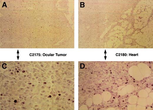 Fig. 4. EBER expression. / Demonstration of EBER-like reactivity in formalin-fixed, paraffin embedded sections of malignant lymphomas by in situ hybridization using labeled oligonucleotide probe. Panels A and C show low- and high-power views, respectively, of positive nuclear staining in the ocular tumor of lymphomatous rabbit C2175, and panels B and D show low- (original magnification, ×40) and high-power (original magnification, ×400) views of the tumor infiltrates of the heart from rabbit C2180.