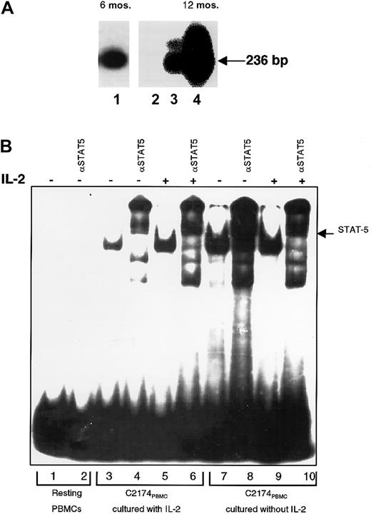 Fig. 5. Establishment of a primary cell-line from the PBMCs of rabbit C2174. / (A) Detection, by PCR and Southern blot hybridization using HVMNE (p536)-specific probe, of HVMNE DNA in the rabbit cell-line C2174 both at 6 and 12 months after culture (lane 1, C2174 after 6 months of culture; lane 2, PCR-negative control; lane 3, cell line J94356 as PCR-positive control; lane 4, C2174 after 12 months of culture). (B) Electrophoretic mobility shift assay to evaluate the Jak/STAT status of the rabbit T-cell line derived from primary culture of rabbit C2174 PBMCs. Transition to IL-2 independence of the C2174PBL cell line was associated with STAT-5 activation. On the top panel, the plus and minus signs represent the use of IL-2 pulse after overnight ligand starvation. αSTAT-5 indicates the addition to the lysate of specific αSTAT-5 antibodies in lanes 2, 4, 6, 8, and 10. Resting PBMCs (lanes 1-2) and the C2174PBL cell line cultured in the presence of IL-2 (lanes 3-6) and in the absence of IL-2 (lanes 7-10) after 8 months of culture.