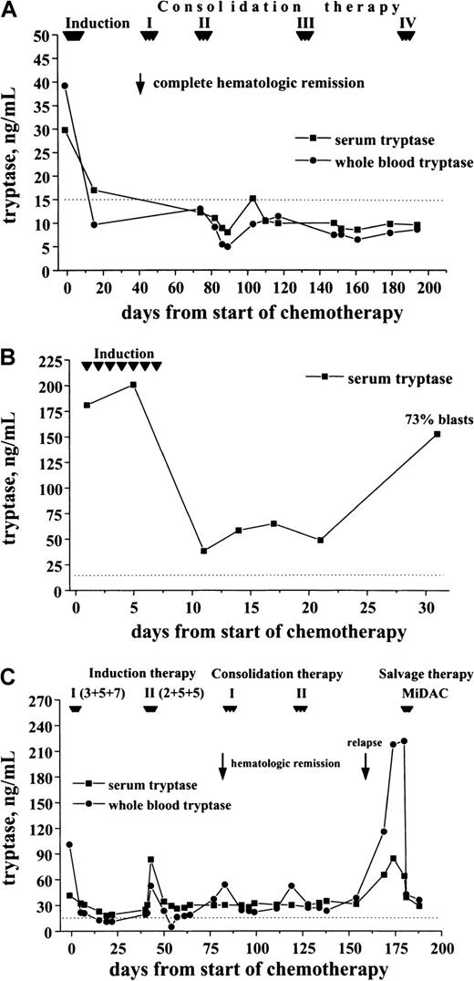 Fig. 10. Follow-up of patients with AML with enhanced tryptase levels. / In patients with AML with elevated serum tryptase, enzyme levels were monitored during and after induction chemotherapy by serial measurements. In patients with continuous CR, serum tryptase levels remained in the normal range (A; M1, 29.8 ng/mL) By contrast, in patients with blast cell persistence or rapid regrowth of blast cells, tryptase levels often remained elevated or showed a recurrent increase. (B) This panel shows a patient (M0, 180 ng/mL) with blast cell persistence (refractory to induction chemotherapy) and persistently elevated serum tryptase. (C) This panel shows a patient with AML M2 (41.6 ng/mL) who entered CR after 2 induction cycles and relapsed during consolidation therapy.