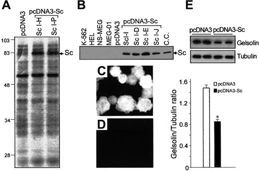 Fig. 2. Expression of scinderin and gelsolin in cell lines. / MEG-01 cells were transfected with either pcDNA3 vectors (control) or the vectors carrying full-length scinderin (Sc) cDNA (pcDNA3-Sc) inserts, as indicated in “Materials and methods.” (A) Coomassie blue-stained SDS-PAGE gel shows Sc protein bands (Sc) for 2 Sc-expressing clones. The band is not seen in the gel corresponding to cells transfected with the pcDNA3 vector (left lane). (B) Western blot performed with a polyclonal antibody raised against recombinant Sc. Lanes from left to right: cell lines K562, HEL, NS-MEG, MEG-01 (wild-type) cells, cells transfected with pcDNA3, 4 Sc-expressing clones, and chromaffin cells (positive control). Immunostaining with Sc antibody of cells transfected with pcDNA3-Sc (C) and pcDNA3 (D). (E) Western blot with a monoclonal gelsolin antibody (top) and levels of gelsolin expression (bottom) in MEG-01 cells transfected with either pcDNA3 or pcDNA3-Sc. Tubulin levels detected by a polyclonal antibody were used as control for gel loading. Bars represent mean ± SEM from 4 different experiments (*P < .001).