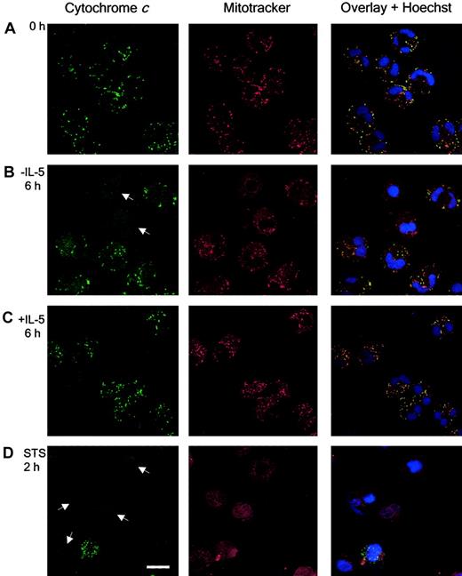 Fig. 5. Cytochrome c is released from the mitochondria during spontaneous and STS-induced eosinophil apoptosis. / Immunocytochemistry was performed, as described in “Materials and methods,” on fixed cytospins of freshly isolated eosinophils (A) or eosinophils cultured in the absence (B) or presence of IL-5 (10−10 M) for 6 hours (C) or STS (10−5 M) for 2 hours (D). Images were captured by confocal microscopy at × 100 magnification under oil immersion. Cytochrome c was detected using a monoclonal antibody 6H2.B4 and the mitochondria and nuclei stained with Mitotracker CMXRos and Hoechst 33258, respectively. Colocalization (yellow) of cytochrome c (green) and mitochondria (red) was observed in single sections. Eosinophils exhibiting evidence of cytochrome c release are indicated (arrows in panels B and D). Culturing in the absence of IL-5 for 6 hours and treatment with STS for 2 hours induced cytochromec release from the mitochondria. Bar represents 10 μm. Results are representative of experiments performed on 4 separate donors.