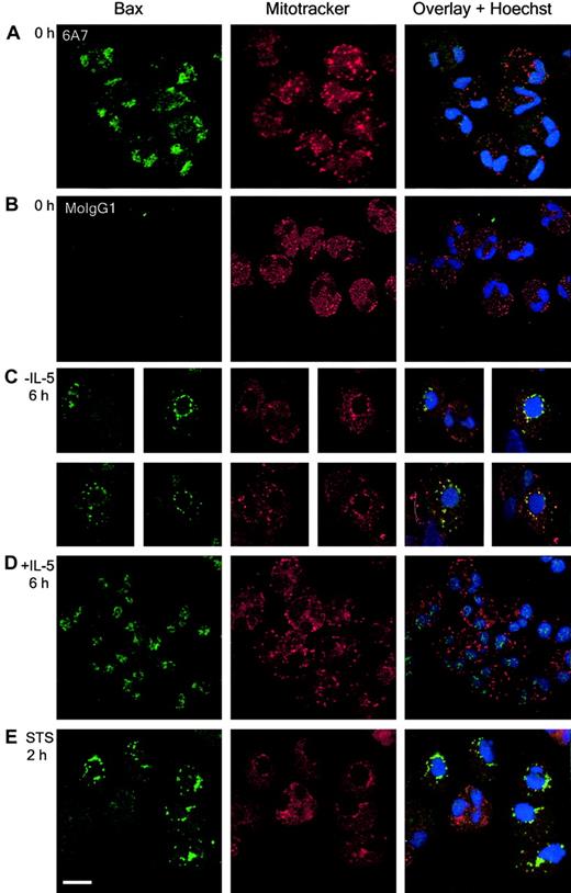 Fig. 7. Bax translocates to the mitochondria during spontaneous and STS-induced eosinophil apoptosis. / Immunocytochemistry was performed, as described in “Materials and methods,” on fixed cytospins of freshly isolated eosinophils (A,B) or eosinophils cultured in the absence (C) or presence of IL-5 (10−10 M) for 6 hours (D) or STS (10−5M) for 2 hours (E). Images were captured by confocal microscopy at × 100 magnification under oil immersion. Eosinophils were stained with monoclonal anti–Bax 6A7 (A,C-E) or isotype-matched control (B), and the mitochondria and nuclei stained with Mitotracker CMXRos and Hoechst 33258, respectively (A-E). Colocalization (yellow) of Bax (green) and mitochondria (red) was observed in single sections. Culturing in the absence of IL-5 for 6 hours and treatment with STS for 2 hours induced Bax translocation to the mitochondria. Bar represents 10 μm. Results are representative of experiments performed on 4 separate donors.
