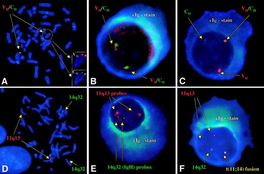 Fig. 1. Normal and abnormal patterns of hybridization with both strategies. / (A) Hybridization of the VH and CH probes to the correct location at band 14q32 on normal human male metaphases. (B) Normal pattern for the VHCH probes with 2 pairs of closely associated signals. Note the intense blue fluorescence of the cytoplasmic light chain. (C) Cellular signal pattern indicative of a 14q32 translocation. The segregation of a pair of signals (break-apart) in a large percentage of cells allows for the identification of a patient with an IgH translocation. (D) Hybridization of the 14q32 and 11q13 probes to the correct locations on chromosomes 14 and 11, respectively, on normal human male metaphases. (E) Normal pattern for the 14q32/11q13 fusion strategy. There are no fusion signals observed, and there are 2 pairs of nonassociated green (14q32) and red (11q13) signals. (F) Abnormal comigration (fusion) of signals indicative of a t(11;14)(q13;q32). Because of the small signal size arising from the VHportion of the IgH probe (owing to the V/D/J recombination and DNA excision), the pattern most frequently observed is presumed to be that of fusions in the der14 and less commonly in the der11.