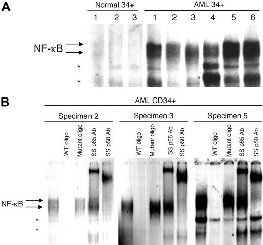 Fig. 1. EMSA of normal and AML CD34+ cells. / NF-κB binding activity is detected in CD34+ AML cells but not in CD34+ normal hematopoietic cells by electrophoretic mobility shift assays. (A) Two different normal bone marrow specimens (lanes 1 and 2) and one normal CB specimen (lane 3) were analyzed for NF-κB binding activity in comparison to 6 CD34+ AML specimens from patients with different FAB types (specimens 1-6 in Table 1). Nuclear extracts equivalent to 100 000 cells were used for each reaction. (B) Competition assays for 3 of the AML samples from panel A. A 200-fold molar excess of unlabeled oligonucleotide (wild-type or mutant) was used. Supershift assays were done by adding 2 μg per reaction of antibodies against NF-κB subunits p65 or p50. Arrows indicate NF-κB species and asterisks indicate nonspecific bands.