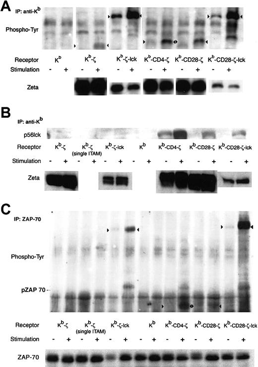 Fig. 3. Biochemical changes after chimeric receptor stimulation. / Crosslinking induced chimeric receptor phosphorylation (A), lck association (B), and ZAP-70 phosphorylation (C) are shown. A quantity of 107 transduced 4G4 cells were incubated with H-2Kb–specific antibody followed by crosslinking with goat antimouse IgG. Lysate was immunoprecipitated with a Kb, or ZAP-70–specific monoclonal antibody. Western blots were probed with antiphosphotyrosine (A, C) or anti-lck (B), stripped, and then probed with ζ-specific (A,B) or ZAP-70–specific (C) antibody to control for gel loading and membrane transfer. Representative analyses are shown. Arrowheads in (A) and (C) indicate tyrosine phosphorylated chimeric receptors. The position of phosphorylated ZAP-70 is shown in (C). As noted in the text, staining of the Kb-ζ-lck and Kb-CD28-ζ–lck receptors with ζ-specfic antibody was consistently poor, and likely reflects a diminished affinity of antibody for these chimeric receptors. In (A), the faint diffuse band present in the unstimulated lane of the phosphotyrosine analysis of Kb-CD4-ζ and migrating slightly lower than the Kb-CD4-ζ construct was not observed in 2 additional experiments and therefore likely represents crossreactive material.