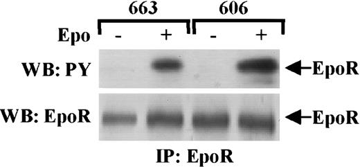 Fig. 1. EpoR is not constitutively activated in HS2 cells. / HS1 cells (663) and HS2 cells (606) were stimulated or not stimulated with 10 U/mL Epo for 10 minutes. Cell lysates were immunoprecipitated (IP) with anti-EpoR antibodies and analyzed by Western blotting (WB) with anti-PY antibodies (upper panel) or with anti-EpoR antibodies (lower panel). Arrows point to phosphorylated EpoR (upper panel) and EpoR (lower panel).