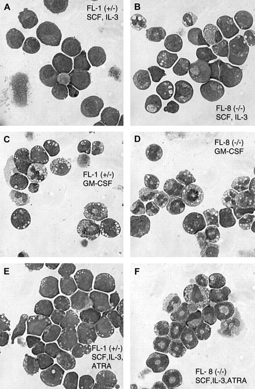 Fig. 2. Morphology of the cultured fetal liver cell lines derived from C/EBPα(+/−) and C/EBPα(−/−) mice. / Cytospin preparations of the FL-1(+/−) and FL-8(−/−) cell lines cultured in the indicated growth factors were stained with Wright-Giemsa. Parental SCF + IL-3 cultured FL-1 and FL-8 (A,B). For GM-CSF stimulation (C, D), cells growing in SCF and IL-3 were washed and resuspended in GM-CSF alone and were cultured for 4 additional days. ATRA stimulation (10 μM) was for 5 days (E, F).