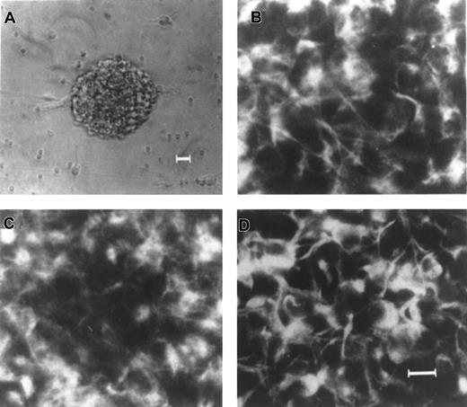 Fig. 1. Expression of nestin, EGFR, and FGFR1 in EGF-generated primary neurospheres from human fetal brain. / (A) An example of a single EGF-generated primary human neurosphere. Immunocytochemical staining of individual EGF-generated primary human neurosphere with antibodies to nestin (B), EGFR (C), and FGFR1 (D), respectively. Scale bars: (A) 25 μm; (B-D) 10 μm.