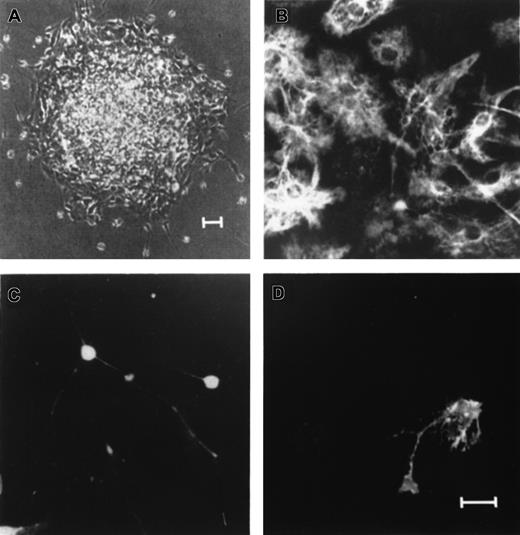 Fig. 2. Single primary EGF-generated human neurospheres contain neurons, astrocytes, and oligodendrocytes. / Individual EGF-generated primary human neurospheres were plated on poly-L-ornithine–coated glass coverslips in differentiation cultures for 7 to 8 days in vitro. (A) An example of a single EGF-generated primary human neurosphere growing on a poly-ornitine–coated glass coverslip for one week in differentiation culture. Triple-labeled immunocytochemical staining of the differentiated neurosphere with antibodies to GFAP (B), MAP-2 (C), and O4 (D) revealed cells with the antigenic and morphologic characteristics of astrocytes (B), neurons (C), and oligodendrocytes (D). Scale bars: (A) 25 μm; (B-D) 5 μm.