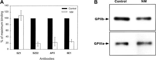 Fig. 1. Expression of GPIIb-IIIa in the patient's platelets. / (A) Cell-surface expression was assessed using monoclonal antibodies (10 μg/mL) directed against the GPIIb-IIIa complex (6E1), GPIIb (SZ22), and GPIIIa (AP3) subunits. Bound IgG was assessed by flow cytometry using FITC-conjugated goat anti–mouse antibody. Results are given as the percentage (mean + range from 4 separate experiments) of the binding of the same antibodies to control platelets, assigned as 100%. N.M.'s platelets expressed about 20% GPIIb-IIIa compared with normal platelets. Surface expression of GPIb was similar on both N.M.'s and control platelets as shown by the binding of SZ1. (B) Total platelet GPIIb-IIIa was evaluated by immunoblotting. SDS-soluble platelet proteins (12 μg) from both control and N.M.'s platelets were subjected to electrophoresis on a 7% polyacrylamide gel under reducing conditions, transferred to PVDF membrane, and incubated with 20 μg/mL rabbit polyclonal antibodies specific for GPIIb and GPIIIa. Bound antibodies were detected using alkaline phosphatase–conjugated goat anti–rabbit IgG, followed by color development using the nitro blue tetrazolium/5-bromo-4-chloro-3-indolyl phosphate substrates.