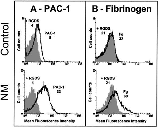 Fig. 2. Spontaneous binding of PAC-1 and fibrinogen to resting platelets. / Platelets were washed and resuspended (2 × 106) in Tyrode-HEPES buffer containing 10−7 M PGE1 and incubated without stimulation with 20 μg/mL FITC–PAC-1 (A) or 250 nM FITC-fibrinogen (B) for 20 and 40 minutes, respectively, at room temperature (RT). Samples were diluted and fixed in 1% formaldehyde and subjected to flow cytometry. The mean fluorescence intensities (MFIs) of PAC-1 and fibrinogen binding in the presence (dark histogram) or in the absence of 2 mM RGDS peptide (clear histogram) obtained for the patient and control are indicated on the histograms. The fact that the patient's platelets expressed only 20% of the usual levels of GPIIb-IIIa reinforces the difference in ligand binding between N.M. and control platelets.