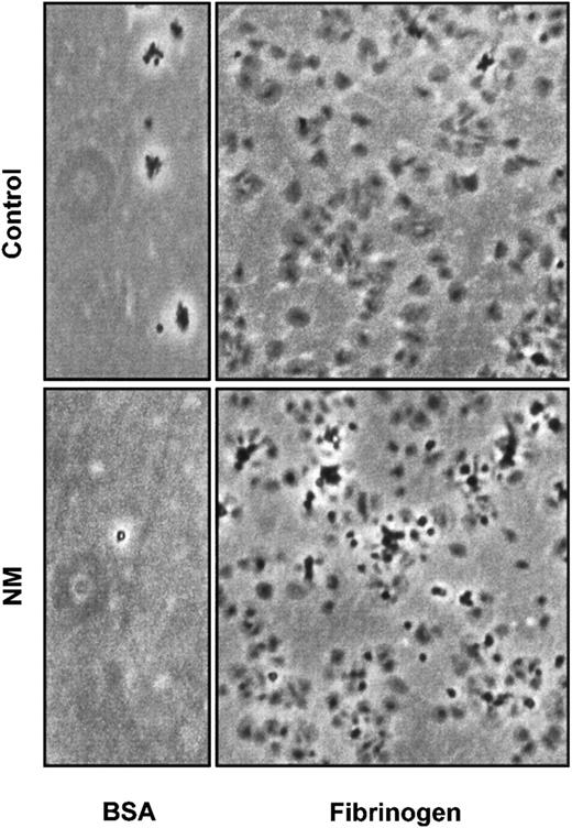 Fig. 10. Platelet adhesion and spreading on immobilized fibrinogen. / Adhesion and spreading of platelets were performed on dishes coated with 100 μg/mL fibrinogen or 5 mg/mL BSA as a control of adhesion. A total of 3 × 108 gel-filtered platelets were allowed to attach on a matrix for 90 minutes at 37°C.