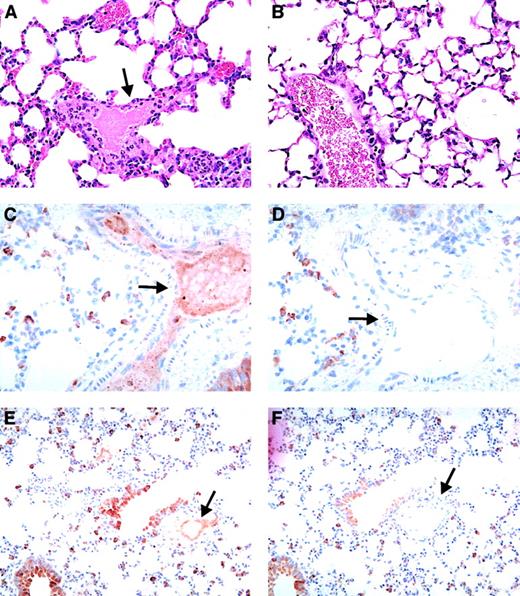 Fig. 3. Vascular pathology in FcγRIIA/hPF4 mice injected with anti-hPF4/heparin antibody and heparin. / Hematoxylin/eosin–stained lung sections from KKO/heparin–treated FcγRIIA/hPF4 mice show intravascular fibrin precipitation and thrombus formation in arterioles and capillaries, as indicated by arrows (panel A, 100 ×), while lung sections from FcγRIIA/hPF4 mice injected with KKO/saline (panel B, 100 ×) show no evidence of thrombus formation. Thrombi in the lungs (panel C, 40 ×; panel E, 20 ×; arterial and venous, respectively) were rich in hPF4, as shown by immunostaining with RTO, a monoclonal antibody specific for hPF4, while staining with an isotype control antibody was negative (panel D, 40 ×; panel F, 20 ×; arterial and venous, respectively).
