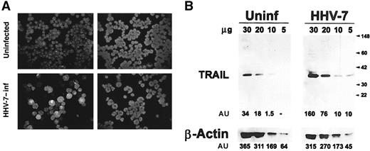 Fig. 1. Expression of TRAIL in uninfected and HHV-7–infected SupT1 cells, evaluated by immunoblotting analysis of cell lysates. / (A) Virus growth was detected by indirect immunofluorescence using the HHV-7–specific 5E mAb. Representative photographs taken 8 days after infection are shown. (left panels) HHV-7–specific immunofluorescence. (right panels) DAPI staining of the nuclei of the same field. Original magnification is × 250. (B) Equivalent amounts of protein lysates obtained from HHV-7–infected (inf) and uninfected (uninf) SupT1 cells were analyzed by Western blot with anti-TRAIL mAb. Equal loading of protein in each lane was confirmed by staining with the antibody to β-actin. Molecular size markers are indicated on the right in kilodaltons. Relative intensities of the bands were densitometrically quantified and expressed in arbitrary units (AU). Results are representative of 5 independent experiments performed.