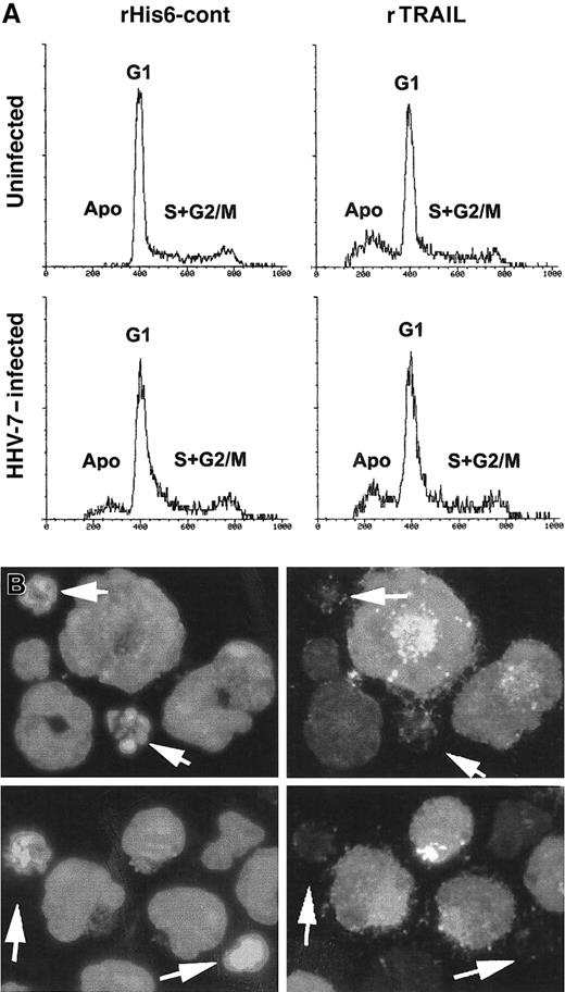 Fig. 7. Evaluation of apoptosis in uninfected and HHV-7–infected SupT1 cells treated with rTRAIL or rHis6-tag control peptide. / (A) Flow cytometric evaluation of apoptosis and cell cycle profile in uninfected and HHV-7–infected SupT1cells after 20 hours of treatment with rHis6-tag control peptide (left panels) or rTRAIL (1 μg/mL) (right panels). The x-axis shows the DNA content, determined based on fluorescence resulting from PI staining, and the y-axis reflects the relative number of cells. Cells in apoptosis (Apo) or in the gap1 (G1), synthesis (S), gap2 (G2), and mitosis (M) phases of the cell cycle are indicated. These results are representative of 4 experiments performed in duplicate. (B) Combined immunofluorescence analysis of HHV-7 antigen expression and apoptotic nuclei after TRAIL-challenge in HHV-7–infected SupT1 cells. Cells are scored by fluorescence microscopy. Note that enlarged cells, characteristic of HHV-7–infected cultures, are positively stained for viral antigens, whereas apoptotic nuclei (arrows) are more frequent among small, uninfected cells. Original magnification is × 400. Representative fields of 5 separate experiments are shown.