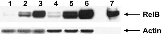 Fig. 3. Expression of RelB by activated DCs. / Nuclear cell extracts from 2 donors (donor 1 lanes 1-3, donor 2 lanes 4-6) were immunoblotted with anti-RelB antiserum 1319, as described in “Materials and methods.” Lanes 1 and 4, immature DCs (GM-CSF–treated); lanes 2 and 5, DCs activated with calcium ionophore; lanes 3 and 6, DCs activated with IFN-γ, TNF-α, and CD40L. Lane 7 represents the control for RelB expression. Antiactin was used to ensure similar levels of protein loading. Results are representative of a single experiment with 3 other experiments demonstrating similar results.