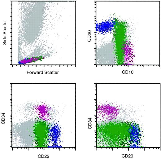 Fig. 3. Flow cytometry histograms of a marrow specimen with increased hematogones. / The histograms illustrate the normal pattern of maturation of B-lymphocyte precursors (hematogones) with the 4-color antibody combination of CD10, CD20, CD22, and CD34. Violet indicates early-stage hematogones; green, intermediate and late-stage hematogones; and blue, mature B cells.