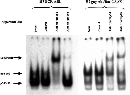 Fig. 6. Supershift analysis of the composition of NFκB complexes in the extracts of H7 BCR-ABL.A54 cells and H7gag-akt/RafCAAX1 cells. / Use of antibodies against relB (control), p65, and p50 reveals the composition of the 2 complexes shared in common by the above cell types. Arrows indicate position of supershift.