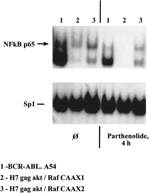 Fig. 9. Capacity for generation of p65 NFκB within H7 cells containing either p210BCR-ABL or gag-akt/RafCAAX is severely inhibited by treatment of cells with parthenolide for 4 hours, whereas Sp1 transcription factor binding activity is unaffected. / Lysates were made of the noted cells treated for 4 hours with parthenolide, 40 μM, and then gel shifts of equal quantities of protein were performed with a radiolabeled NFκB oligonucleotide probe.