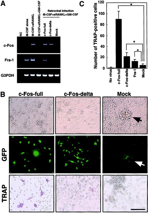 Fig. 5. Down-regulation of c-Fos is a key event for the inhibition of osteoclastogenesis in the presence of GM-CSF. / The c-Kit+c-Fms+RANK− cells were cultured in the presence of M-CSF (100 ng/mL) alone; M-CSF and sRANKL (25 ng/mL); and M-CSF, sRANKL, and GM-CSF (1 ng/mL) for 6 days. The effect of retroviral infection with full-length c-Fos (c-Fos–full), truncated c-Fos (c-Fos–δ) or mock-infected cells was examined in cultures containing M-CSF and sRANKL and GM-CSF. Expression of c-Fos, Fra-1, and G3PDH was examined by RT-PCR on day 6 (A). NC indicates no template control. Expression of Fra-1 was induced by c-Fos–full but not by c-Fos–δ. Retroviral infection could be detected by GFP expression visualized with a fluorescence microscope (B). Cell spreading and disappearance of cell clusters were observed following infection with c-Fos–full or c-Fos–δ but not in mock-infected cells (arrow indicates cell cluster). Significant increases in TRAP-positive cells were detected in the c-Fos–full infection (B,C). Bar = 25 μm.