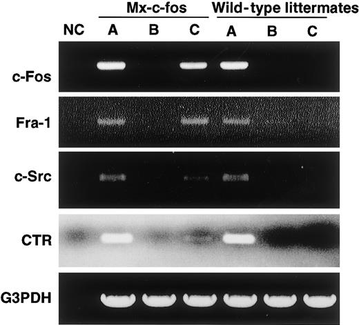 Fig. 7. Cells are committed to an osteoclast lineage by c-Fos induction, but Jun proteins are not involved in the rescue of osteoclastogenesis. / The expression of c-Fos, Fra-1, c-Src, CTR, and G3PDH was examined in c-Fms+RANK− cells cultured for 6 days with M-CSF and sRANKL (A); M-CSF, sRANKL, and GM-CSF (B); and M-CSF, sRANKL, GM-CSF, and IFN-α/β (C). NC indicates no template control. Expression of Fra-1, c-Src, and CTR was observed following induction of c-Fos.