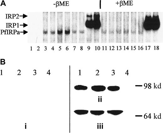 Fig. 4. Expression of PfIRPa is iron dependent. / (A) Gel-retardation assays of human IRP1- and PfIRPa-mammalian IRE complexes are shown. Lanes 1 and 2, 32P-IRE alone; 3, 4, 11, and 12, 2-6 μg protein isolated from fructose-supplementedP falciparum cultures; 5, 6, 13, and 14, 6 μg protein isolated from cultures treated with 100 μM DFO for 18 hours; 7, 8, 15, and 16, 6 μg protein isolated from cultures supplemented with 25 μM FeCl3; 9, 10, 17, and 18, 6 μg lysate protein from a human EBV cell line expressing IRP1 and IRP2. Lanes 3 to 10, no β-mercaptoethanol; lanes 11 to 18, 1% β-mercaptoethanol was added to lysate-IRE incubation mixtures before loading the gel. The lysate proteins were incubated with 1.0 pmol/lane of 32P-IRE and resolved on an 8% polyacrylamide gel. (B) Western blot analysis of expression of P falciparum IRP. Protein (10 μg) isolated from P falciparum cultures was exposed to fructose for 18 hours (lane 1), from cultures treated with 100 μM DFO plus fructose for 18 hours (lanes 2), from cultures supplemented with 25 μM iron as FeCl3 plus fructose (lane 3), or isolated from a human EBV cell line expressing IRP1 (lane 4) were resolved on 8% SDS-polyacrylamide gel. The position of the molecular marker of 98 000 dalton is shown. The proteins were transferred to nitrocellulose and probed with antisera from nonimmune rabbits (prebleed, panel i), or with antibody 3950 (panel ii). Afterward, the nitrocellulose shown in panel B was stripped of antibody 3950 and was probed with an antibody against the plasmodial protein BiP (GRP) (panel iii). The visualization of the proteins was achieved after probing with a secondary, peroxidase-linked antibody in an enhanced chemiluminescence assay.